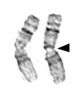 Microscopy image of two metaphase chromosomes.