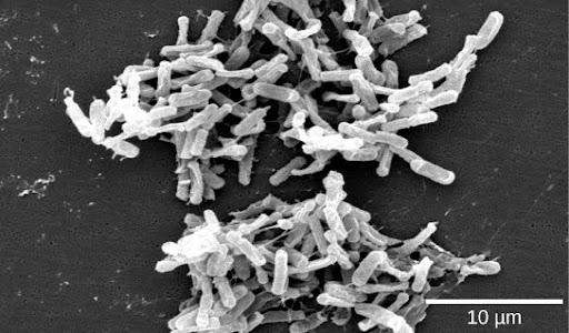 A Scanning Electron Micrograph showing Gram-positive Clostridium difficile bacteria